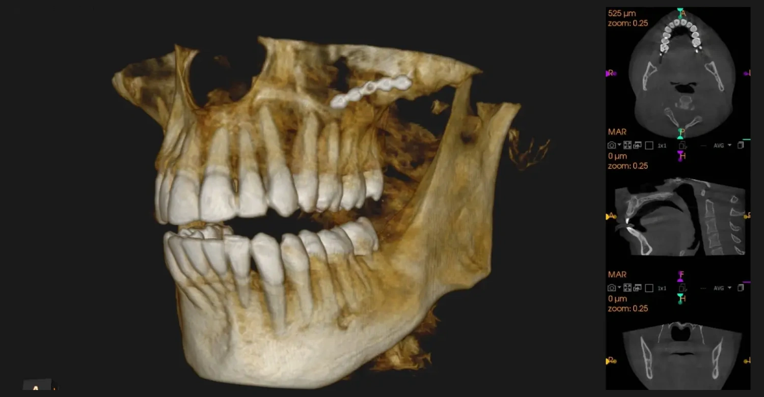 how 3d cbct improves orthodontic treatment planning Inblog